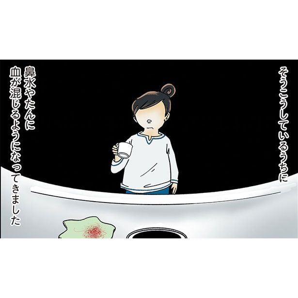 『鼻腔ガンになった話』 やよいかめ
