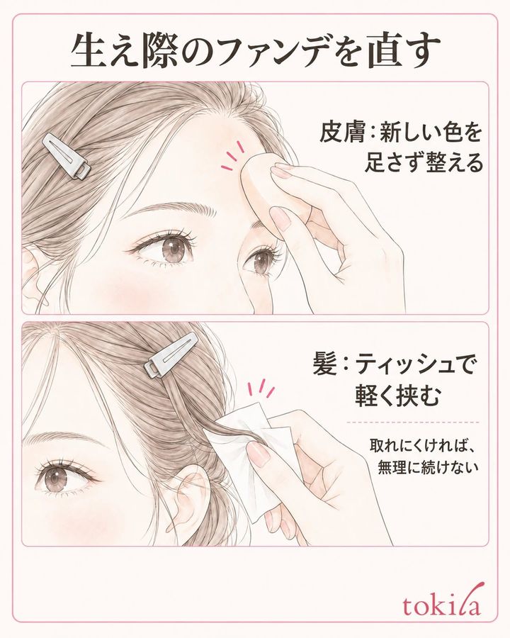 皮膚と髪を分けて直すを説明する額と生え際、道具の図