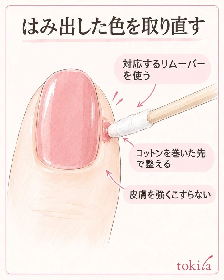 対応するリムーバーを使い、コットンを巻いた先で狭い範囲を整えます。皮膚を強くこすりません。
