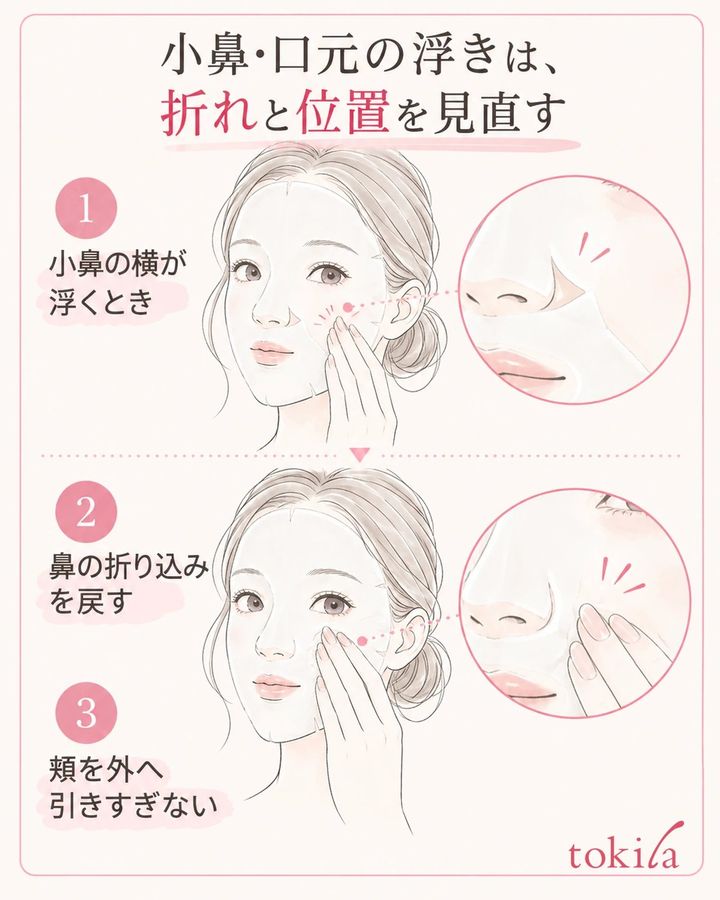 小鼻の横の浮きは、シートの折れと引っ張りを見直す。