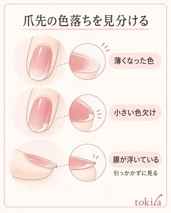 爪先の色の膜を観察し、薄い色落ち・小さな欠け・広い浮きを分けます。