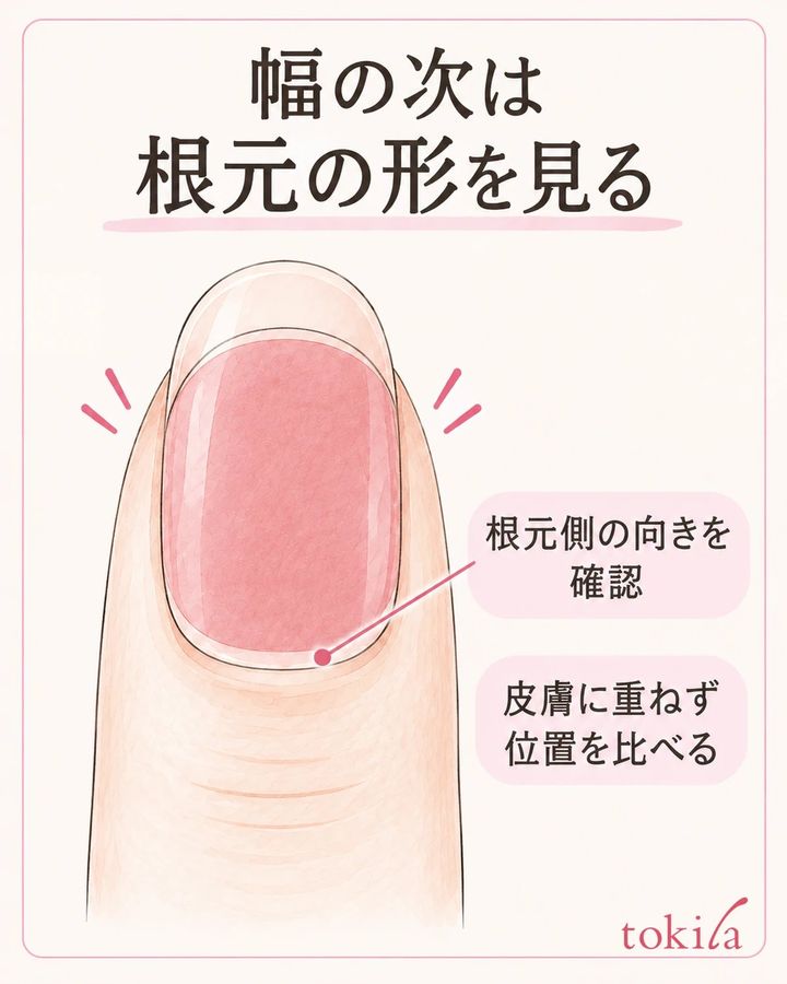 根元側の向きを確かめ、シールのカーブが皮膚へ重ならない位置を比べる。