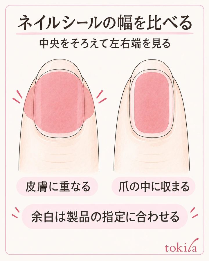 中央をそろえて左右端を見比べ、皮膚への重なりと位置のずれを分けて確認する。