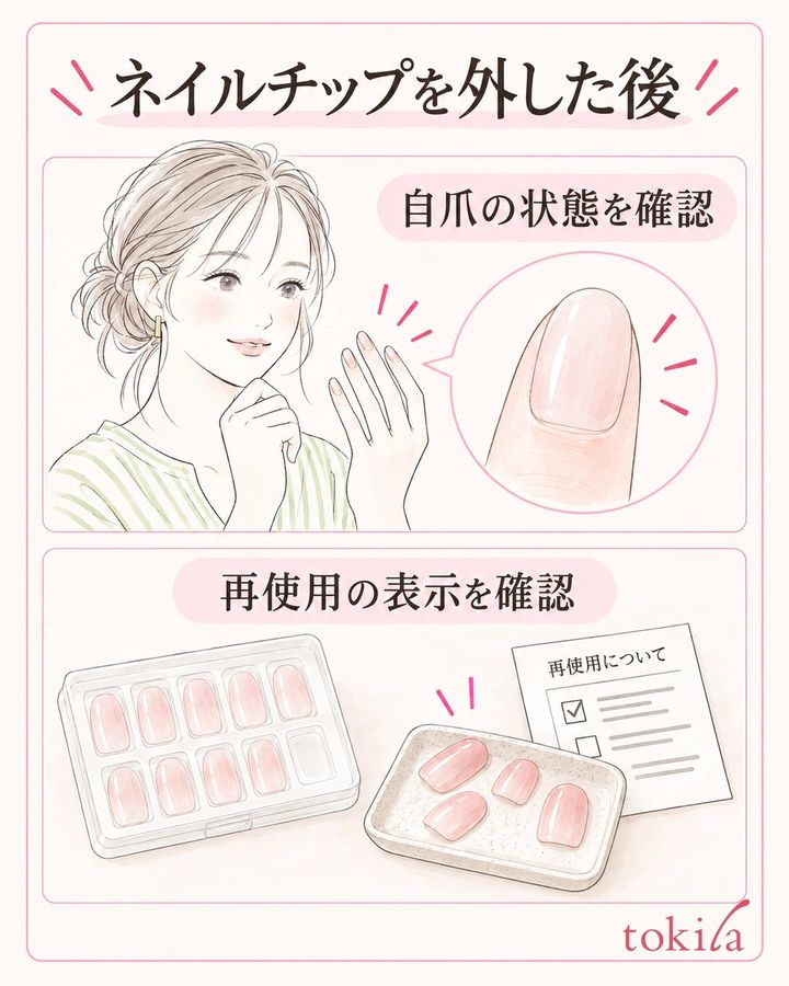 自爪の残りと、外したチップの再使用条件を別々に確認します。