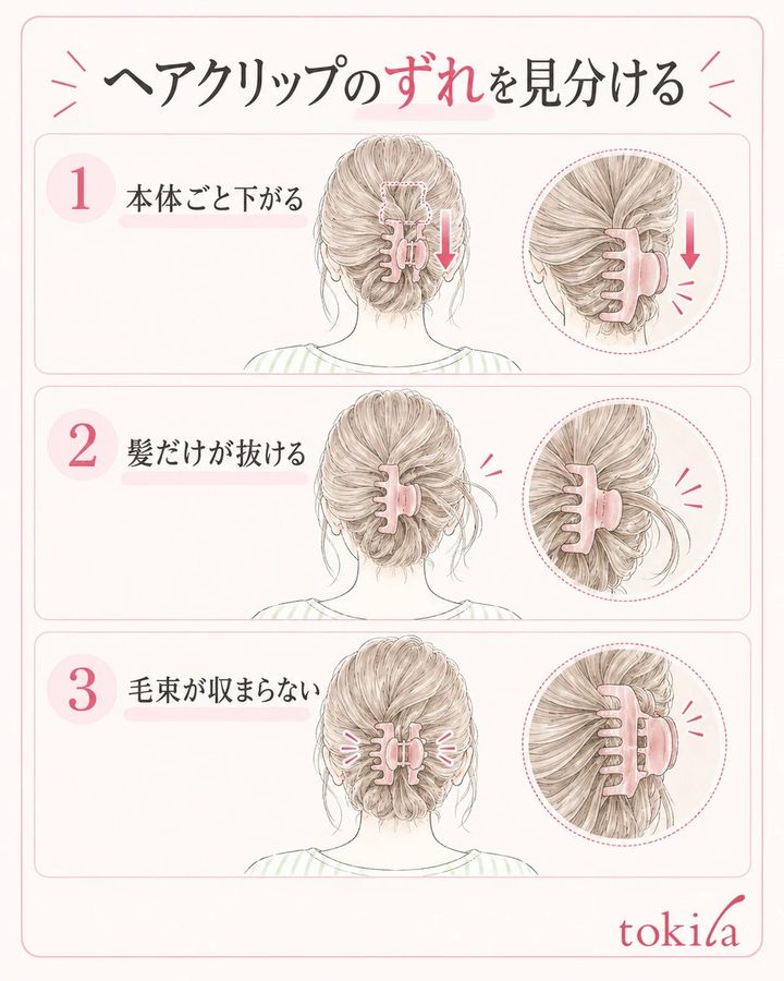 本体全体が下がる状態、髪だけが抜ける状態、毛束が収まらない状態を分けます。