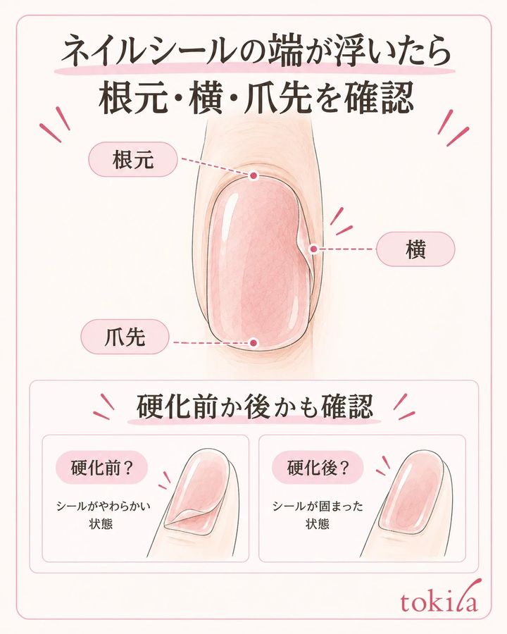 根元・横・爪先の場所と、硬化前後の段階を分けて確認します。