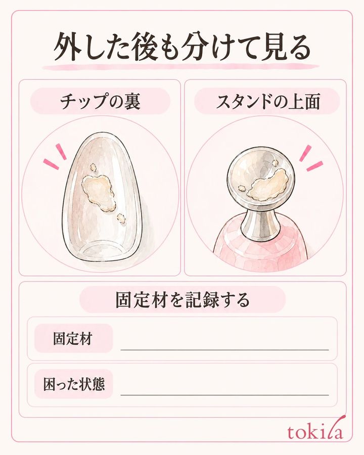 チップ裏と台の上面を分け、固定材と困った状態を記録します。