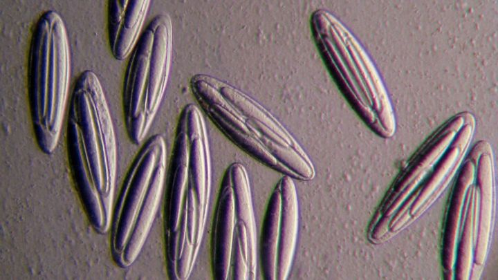 人間の腸にも「巨大細菌」が潜んでいる可能性がある