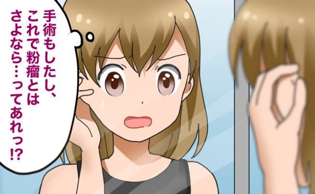粉瘤治療 イメージイラスト