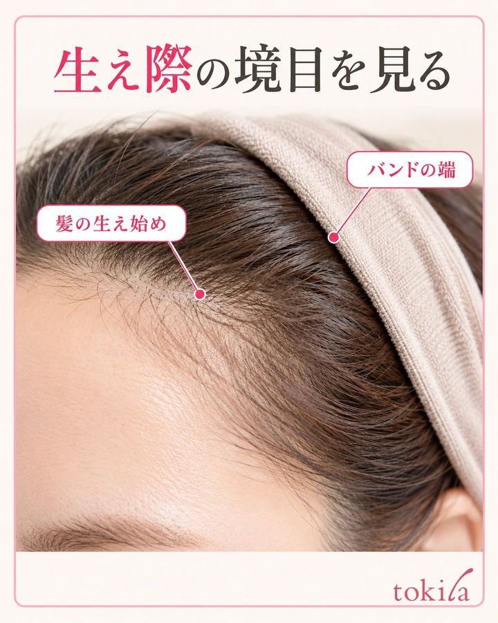 髪の生え始めとヘアバンドの端を分けて見ます。