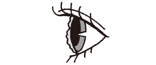 涙が不足したドライアイ