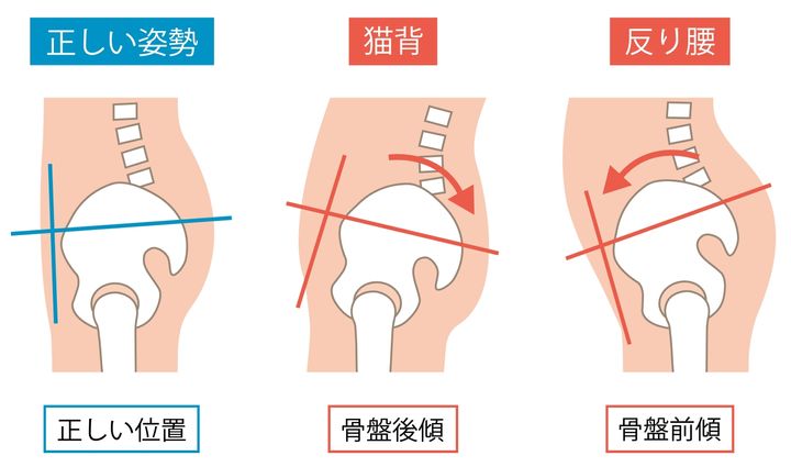 骨盤の後傾、前傾
