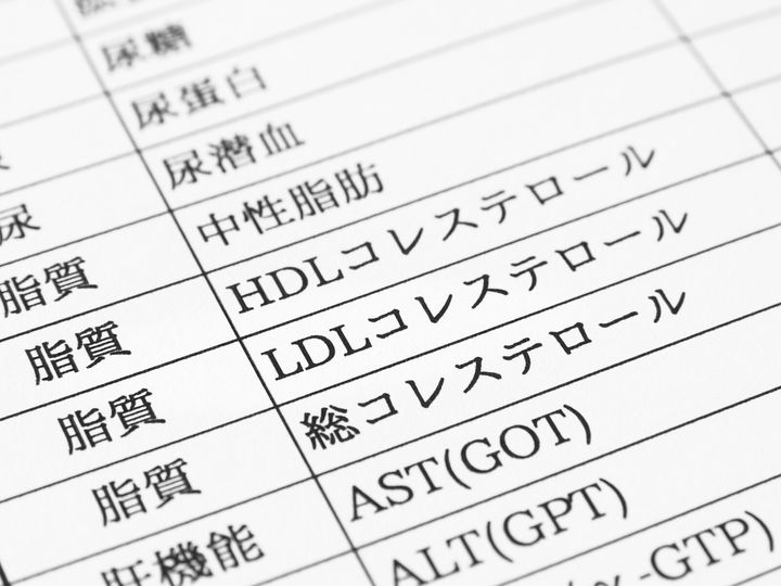 健康診断で気になるコレステロール値。「悪玉」と呼ばれるLDLは、とにかく低ければ安心なのだろうか。東大名誉教授が、その役割と数値の見方を解説する。※サムネイル画像：PIXTA