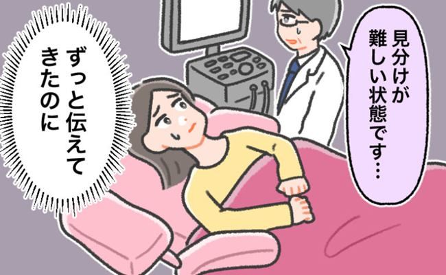 婦人科系の病気の診察 イメージカット