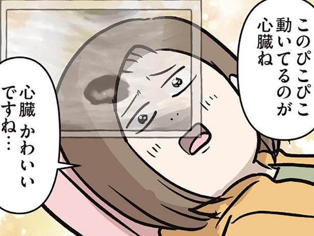 赤ちゃんの心臓が見えた…！ （C）えむふじん／KADOKAWA