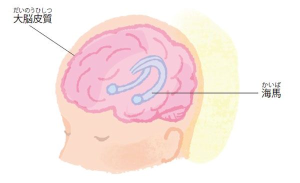 アルツハイマー型認知症では記憶に重要な「海馬」が傷付く