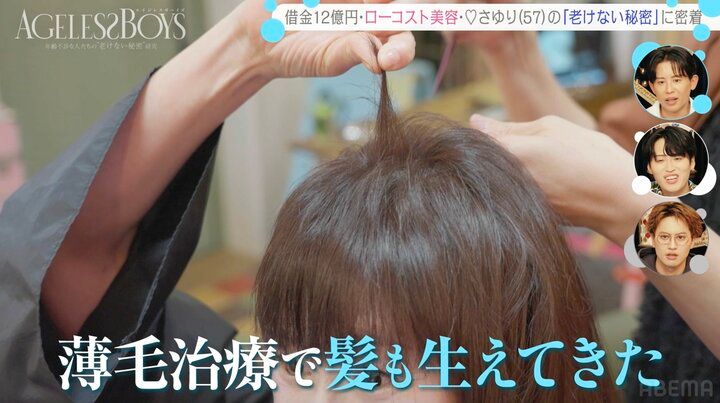 【写真・画像】“ミスコン荒らし“57歳女性芸人、2時間睡眠生活で「お札ぐらいの円形脱毛症ができた」 薄毛治療も 2枚目