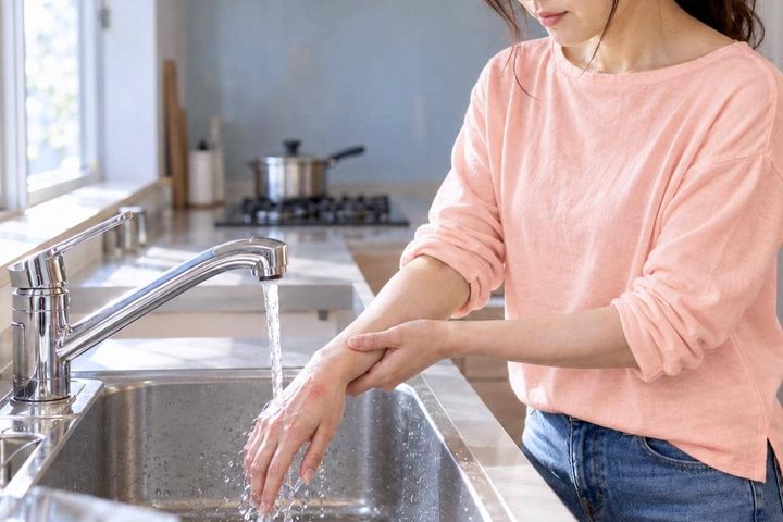 料理中にやけど…氷で冷やしてない？まず流水で冷やしたい理由と、受診の目安