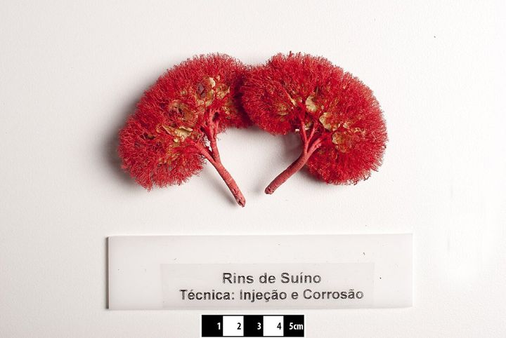 −150℃で1年眠ったブタの腎臓、移植するとすぐに尿を作った