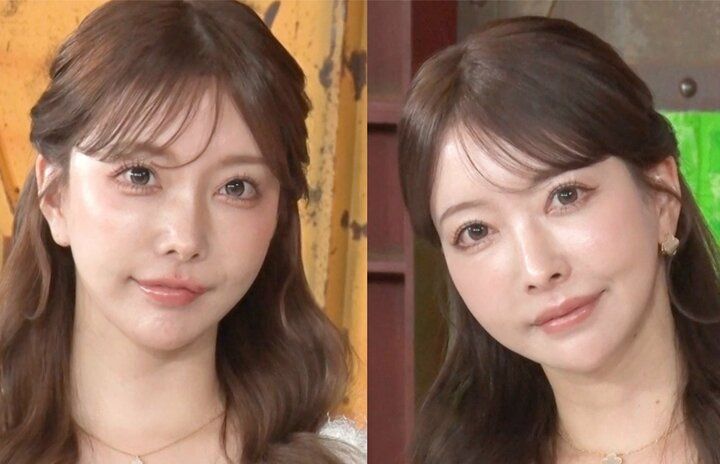 【写真・画像】“整形総額4000万円”美人双子姉妹、容姿コンプレックスを持ったきっかけ「中学生の時に姉の方が可愛いと言われ…」 1枚目