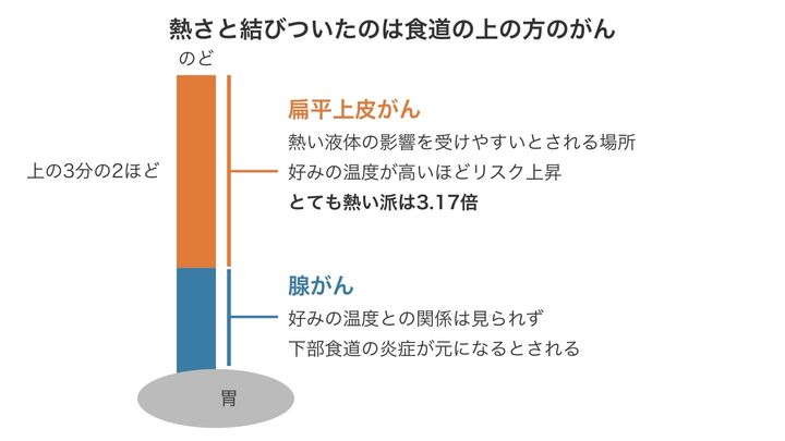 食道で2種類のがんができやすい場所を示した図で、形や長さは正確ではありません。温度と結びついていたのは上の方にできやすいがんだけで、研究チームは、熱による傷という説明を支えるように見えると述べています。