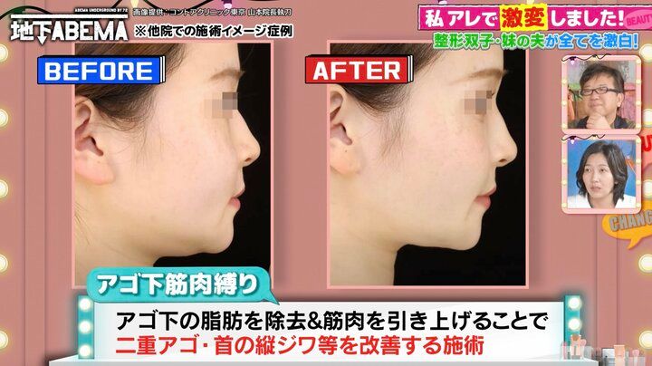【写真・画像】「双子の娘が共に整形」実母が本音を告白「最初は大反対」「元々私に似て可愛かったのに…」 2枚目