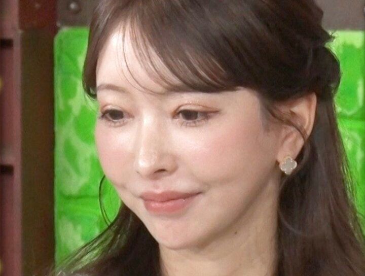 【写真・画像】「双子の娘が共に整形」実母が本音を告白「最初は大反対」「元々私に似て可愛かったのに…」 1枚目