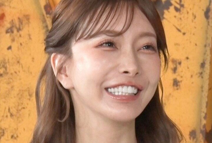 【写真・画像】「整形総額4000万円」美人双子姉妹、乳輪整形で失敗「色素が抜けすぎて…」 1枚目