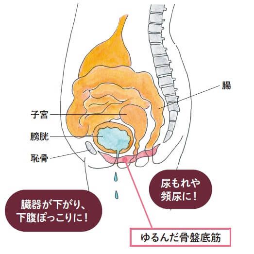 1-03_ゆるんだ骨盤底筋
