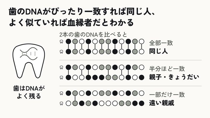 歯のDNAで持ち主を見分ける