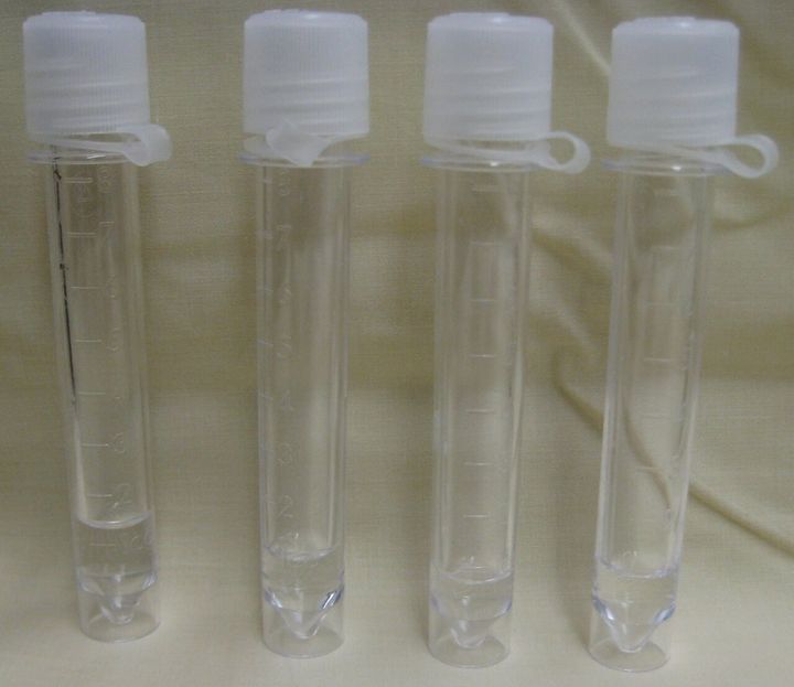 腰の背骨の間に針を刺して採った、人の脳脊髄液が入った4本の容器です。見た目はふつうの状態の脳脊髄液です。