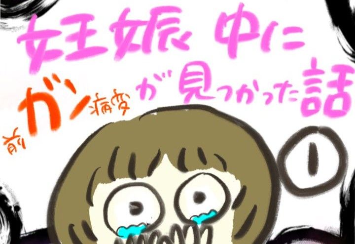 妊娠中に前ガン病変が見つかった話のサムネイル